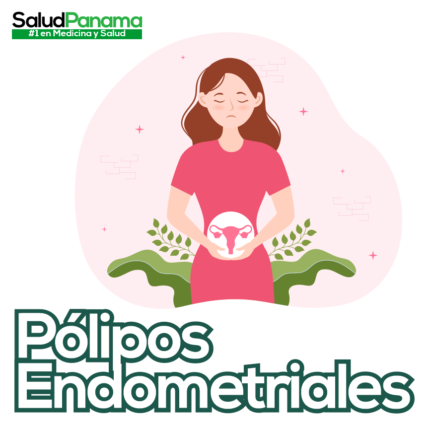 Pólipos Endometriales