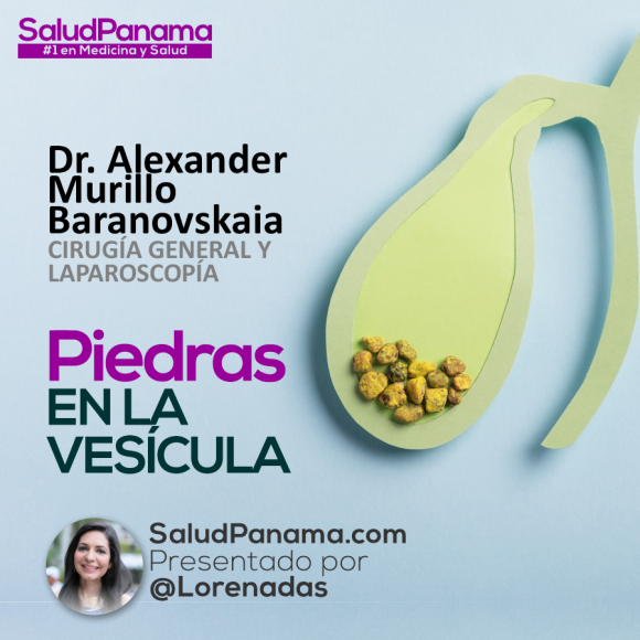 Piedras en la Vesícula con Dr. Alexander Murillo Baranovskaia